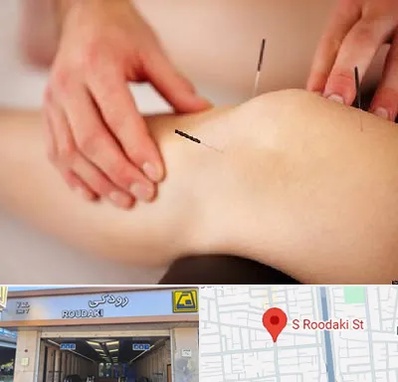 دکتر طب سوزنی برای لاغری در رودکی