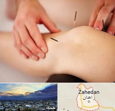 دکتر طب سوزنی برای لاغری در زاهدان