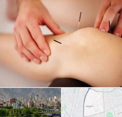 دکتر طب سوزنی برای لاغری در جمشیدیه