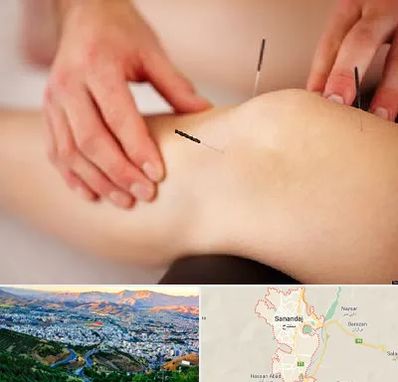 دکتر طب سوزنی برای لاغری در سنندج