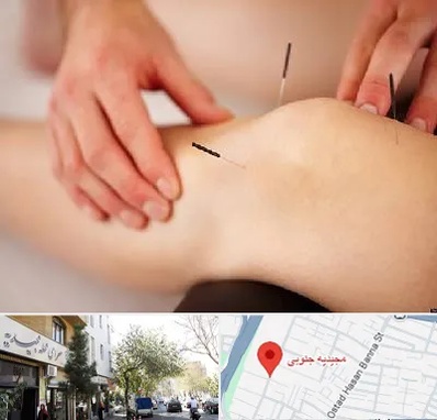 دکتر طب سوزنی برای لاغری در مجیدیه جنوبی