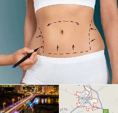 دکتر طب سنتی برای لاغری در سقز