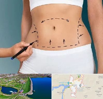 دکتر طب سنتی برای لاغری در مهاباد