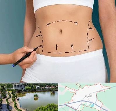 دکتر طب سنتی برای لاغری در لنگرود