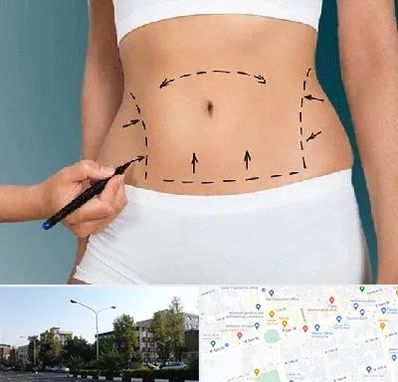 دکتر طب سنتی برای لاغری در میدان کاج 