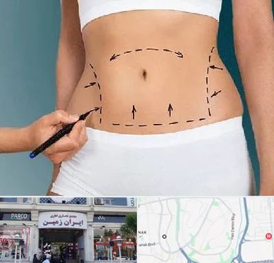 دکتر طب سنتی برای لاغری در ایران زمین