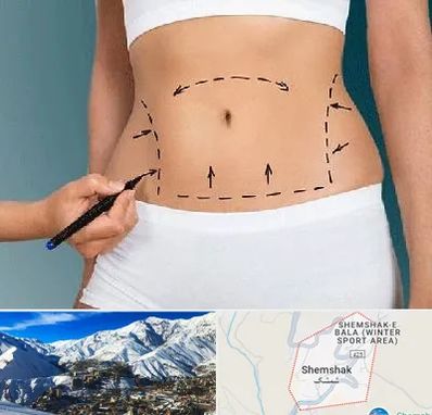 دکتر طب سنتی برای لاغری در شمشک