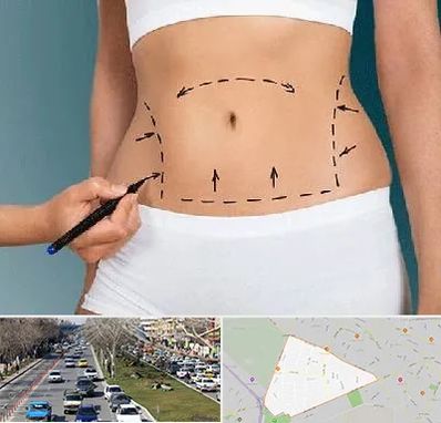 دکتر طب سنتی برای لاغری در احمدآباد مشهد 