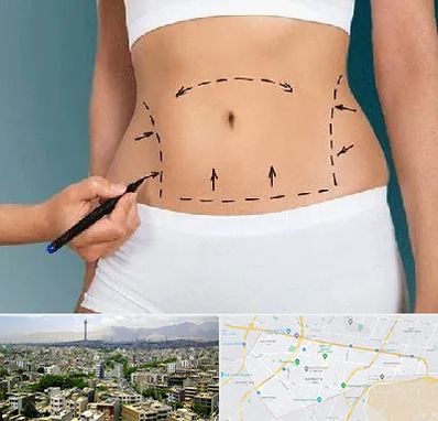 دکتر طب سنتی برای لاغری در منطقه 8 تهران 