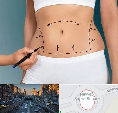 دکتر طب سنتی برای لاغری در نواب 