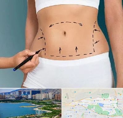 دکتر طب سنتی برای لاغری در منطقه 22 تهران 