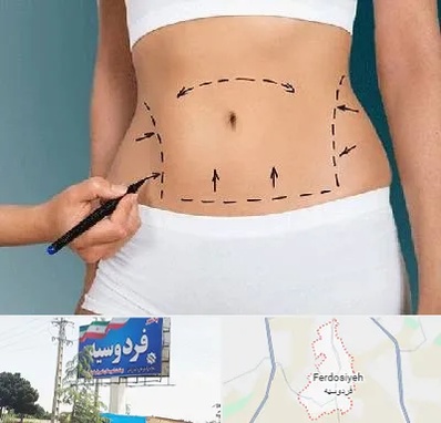 دکتر طب سنتی برای لاغری در فردوسیه شهریار