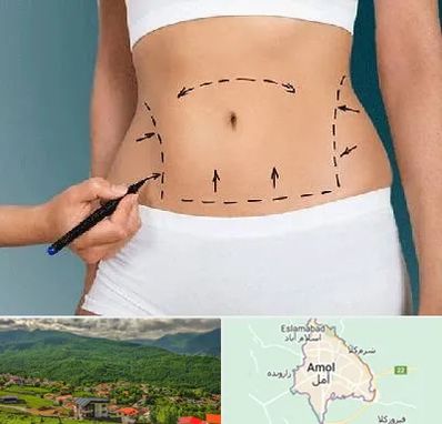 دکتر طب سنتی برای لاغری در آمل