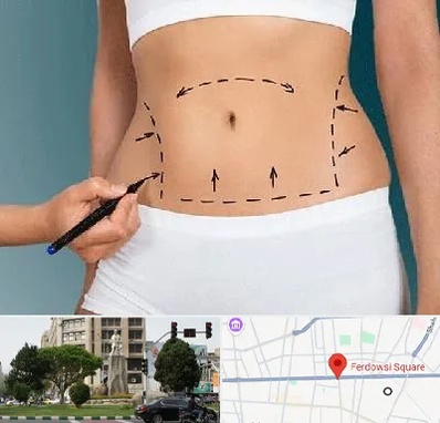 دکتر طب سنتی برای لاغری در میدان فردوسی تهران