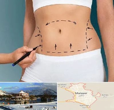 دکتر طب سنتی برای لاغری در ملایر