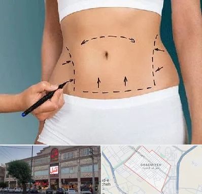 دکتر طب سنتی برای لاغری در قائمیه اسلامشهر 