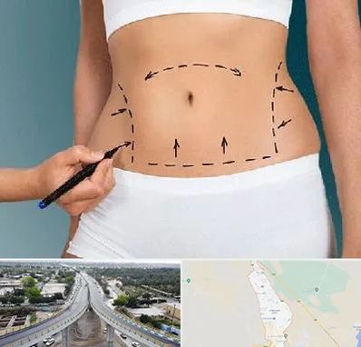 دکتر طب سنتی برای لاغری در اندیمشک