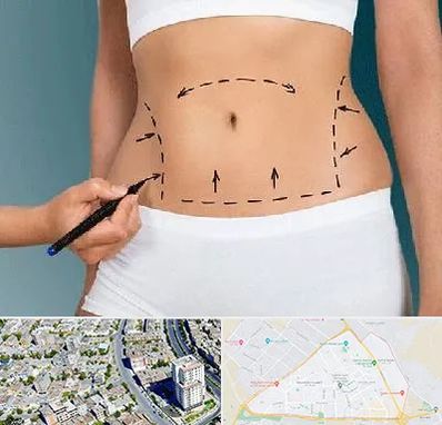 دکتر طب سنتی برای لاغری در قاسم آباد مشهد 