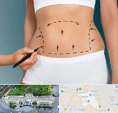 دکتر طب سنتی برای لاغری در نسیم شهر