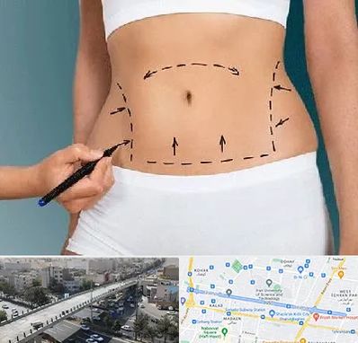 دکتر طب سنتی برای لاغری در فرجام 