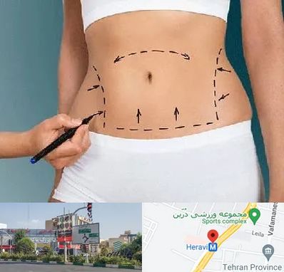 دکتر طب سنتی برای لاغری در هروی 