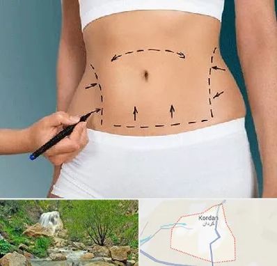 دکتر طب سنتی برای لاغری در کردان