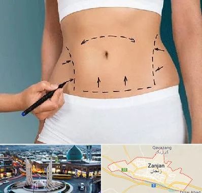 دکتر طب سنتی برای لاغری در زنجان