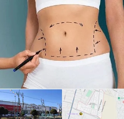 دکتر طب سنتی برای لاغری در فاز دو اندیشه
