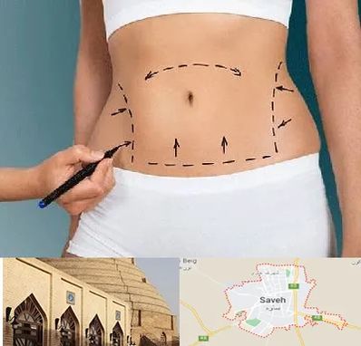 دکتر طب سنتی برای لاغری در ساوه