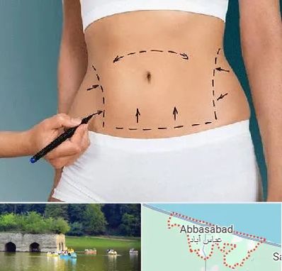 دکتر طب سنتی برای لاغری در عباس آباد