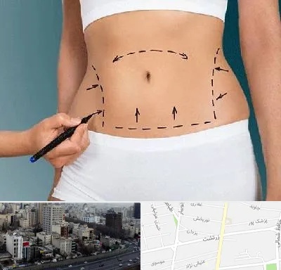 دکتر طب سنتی برای لاغری در زرتشت