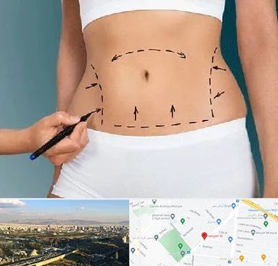 دکتر طب سنتی برای لاغری در هنگام 