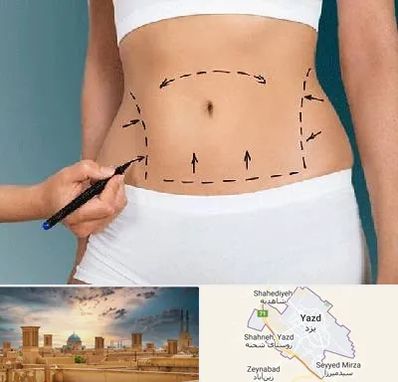 دکتر طب سنتی برای لاغری در یزد
