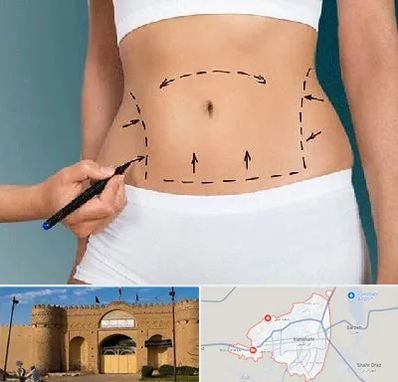 دکتر طب سنتی برای لاغری در ایرانشهر