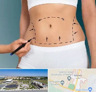 دکتر طب سنتی برای لاغری در ملارد