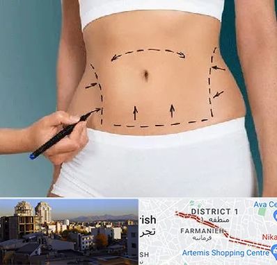 دکتر طب سنتی برای لاغری در فرمانیه 