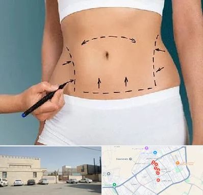 دکتر طب سنتی برای لاغری در نواب اسلامشهر 