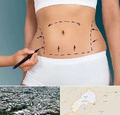 دکتر طب سنتی برای لاغری در شاهرود