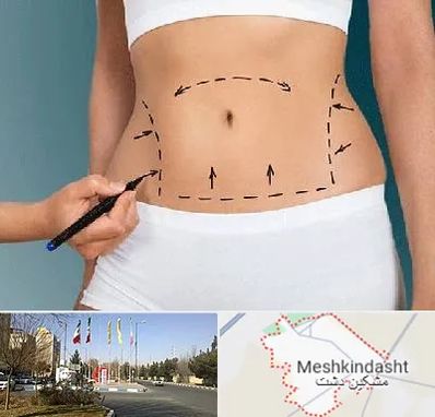 دکتر طب سنتی برای لاغری در مشکین دشت