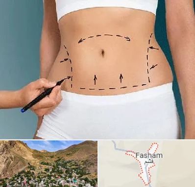 دکتر طب سنتی برای لاغری در فشم