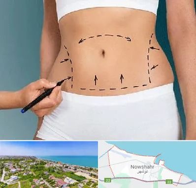 دکتر طب سنتی برای لاغری در نوشهر