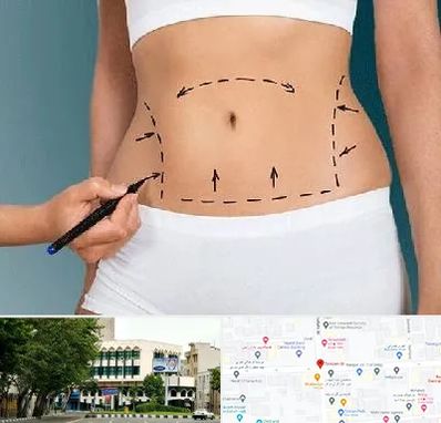 دکتر طب سنتی برای لاغری در طالقانی 