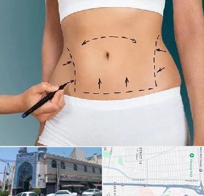 دکتر طب سنتی برای لاغری در بلوار ابوذر