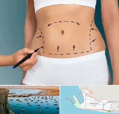 دکتر طب سنتی برای لاغری در چابهار