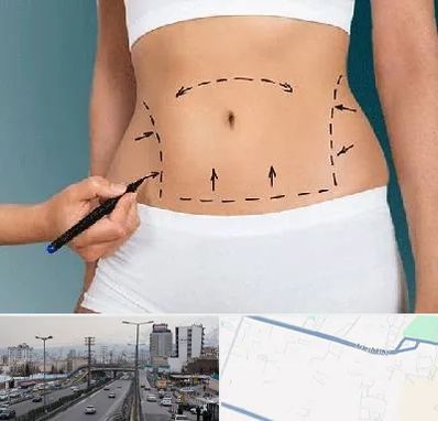 دکتر طب سنتی برای لاغری در بلوار ارتش