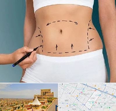 دکتر طب سنتی برای لاغری در هاشمیه مشهد 