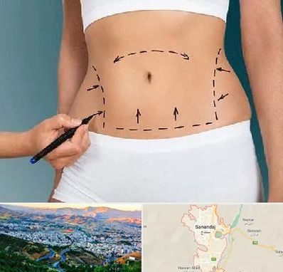 دکتر طب سنتی برای لاغری در سنندج