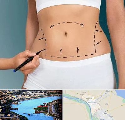 دکتر طب سنتی برای لاغری در خرمشهر