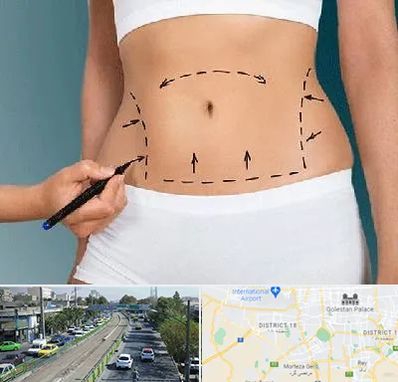 دکتر طب سنتی برای لاغری در جنوب تهران 