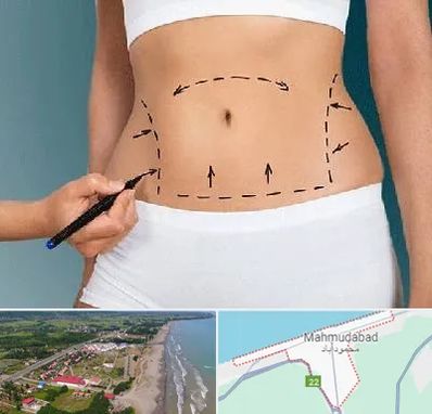 دکتر طب سنتی برای لاغری در محمودآباد